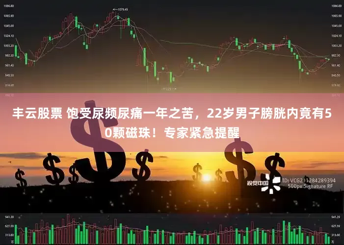 丰云股票 饱受尿频尿痛一年之苦，22岁男子膀胱内竟有50颗磁珠！专家紧急提醒